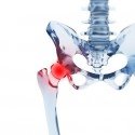 Chiropractic for Hip Pain